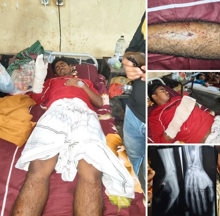 পাবনায় ছাত্রশিবির নেতার ওপর হামলা, গুরুতর আহত