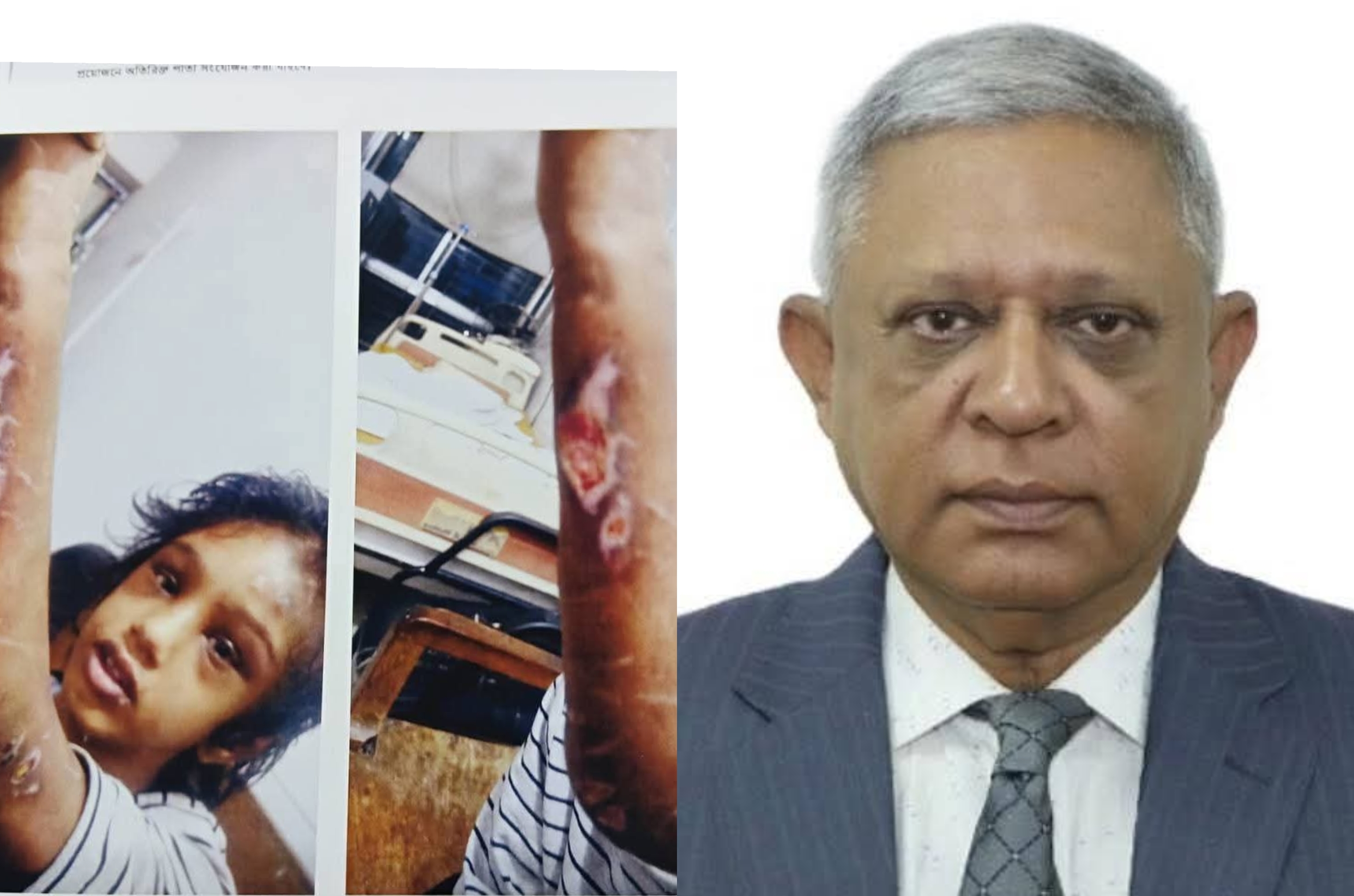 শিশু মোহনা হত্যা: আইনের শাসন ভেঙে ‘টাকা–ক্ষমতা–মিডিয়া’ দিয়ে কি মানবাধিকার ধ্বংসের চেষ্টা চলছে?”